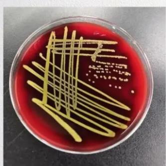 微生物培养基的分类和用途|常见标本类型及对应的培养基选择