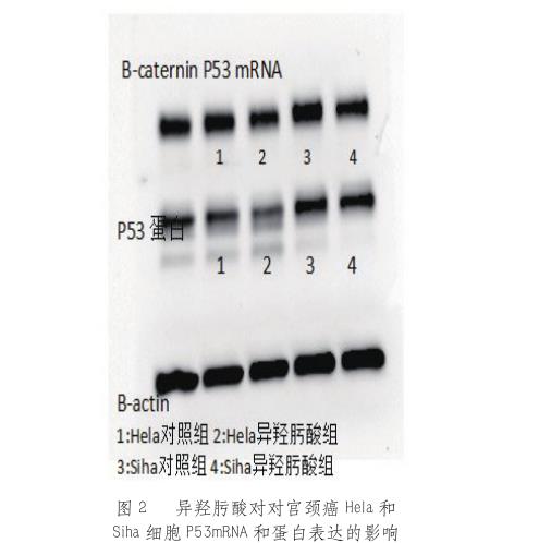 新型靶向抗癌药HDAC抑制剂可诱导肿瘤细胞分化、选择性凋亡——结果与讨论