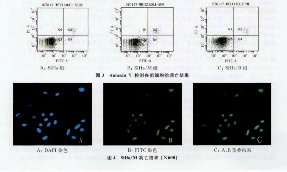 Annexin V联合PI法、TUNEL法测定：防御素可诱导转染细胞SiHa凋亡（二）