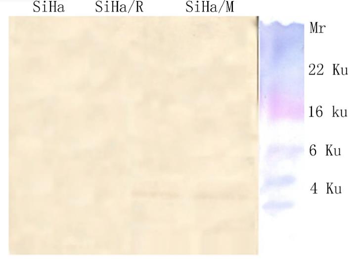 Annexin V联合PI法、TUNEL法测定：防御素可诱导转染细胞SiHa凋亡（一）